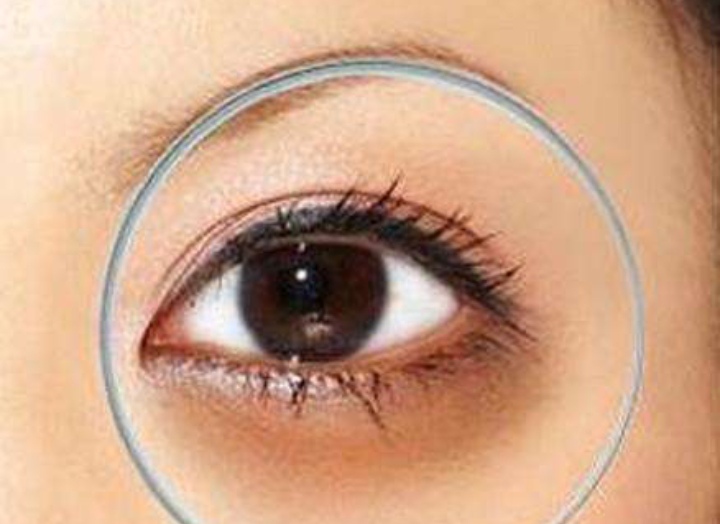 【百科知識】黑眼圈的改善方法