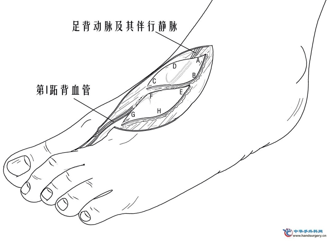 大学生自救指南：常见的动脉位置和止血急救方法-第13张