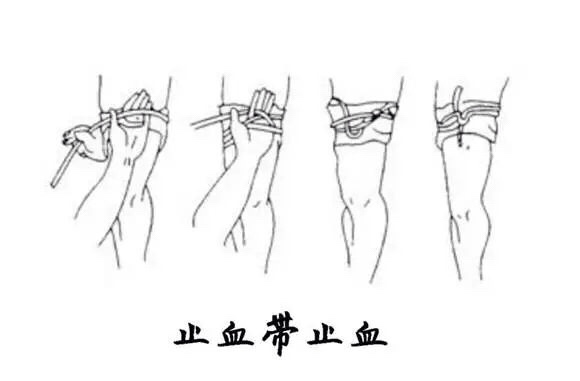 大学生自救指南：常见的动脉位置和止血急救方法-第19张