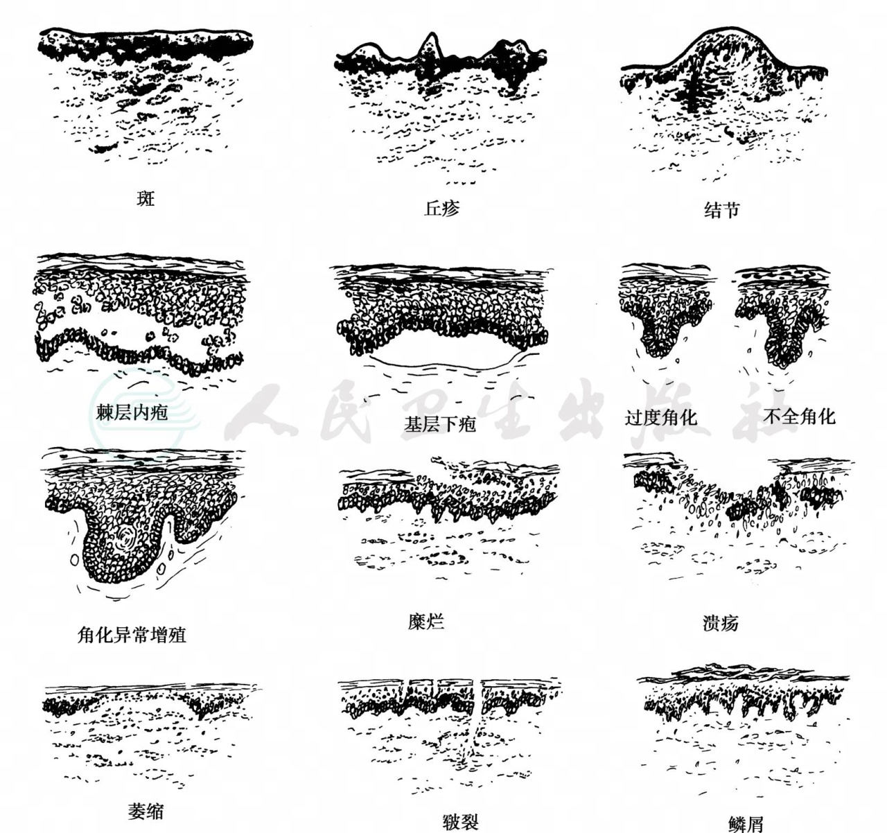 疾病详情-疾病-人卫临床助手-人民卫生出版社