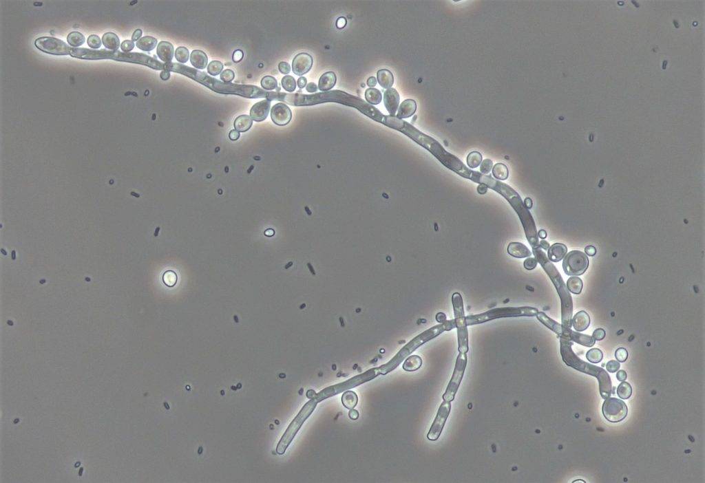 What fungi live in the gut? Meet the gut mycobiome - Quadram Institute