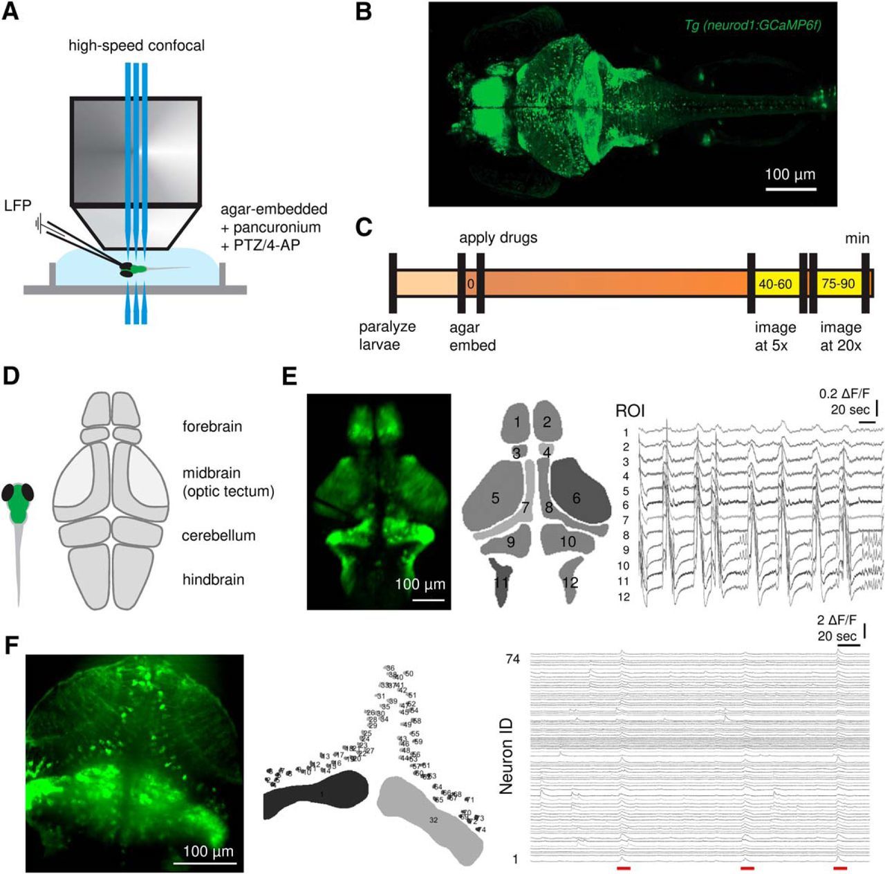 Network Properties Revealed during Multi-Scale Calcium Imaging of Seizure  Activity in Zebrafish | eNeuro