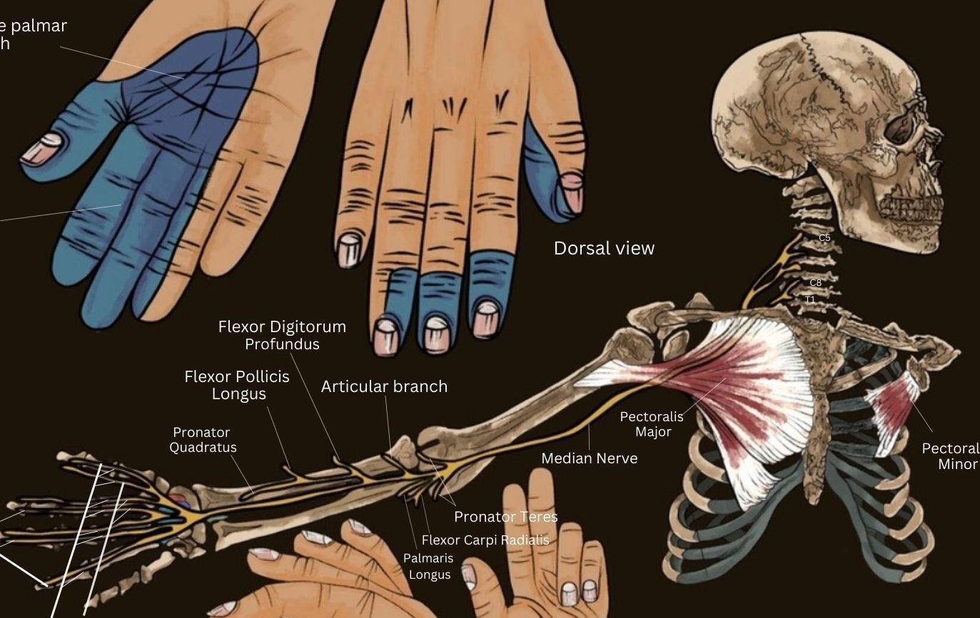 Median Nerve Neuropathy & Injury