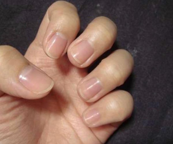 指甲健康的秘密- 斑點、紋理和光澤| Rainbow Nails' Blog