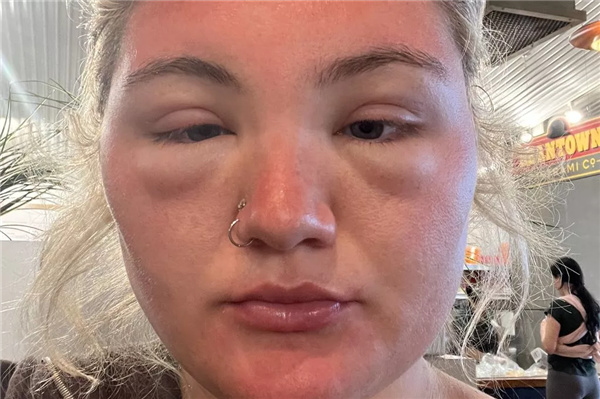 英国发明“人皮手机壳”：阳光下会像人皮一样晒伤