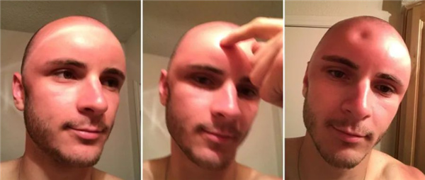 英国发明“人皮手机壳”：阳光下会像人皮一样晒伤