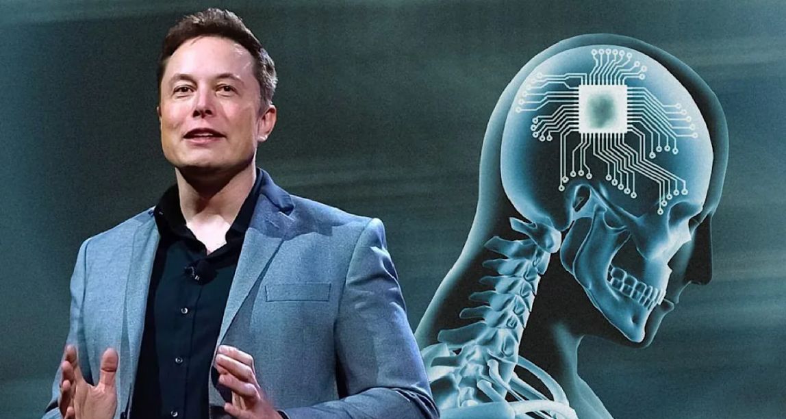 馬斯克：腦機接口通過審批，全球首次人體臨牀試驗！