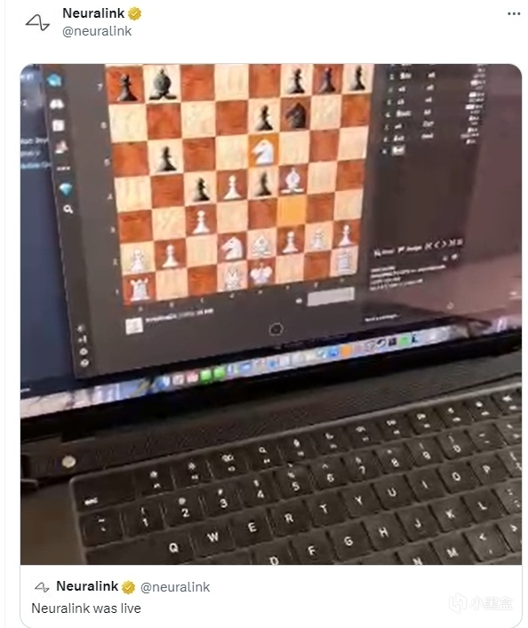 马斯克：脑机接口新突破，患者用意念打游戏！