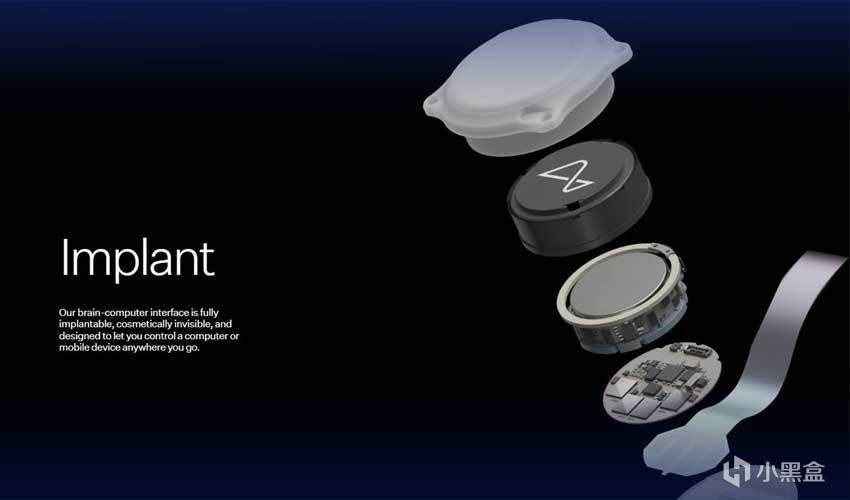 【球盟会】马斯克：脑机接口首例植入者，芯片接线发生故障！