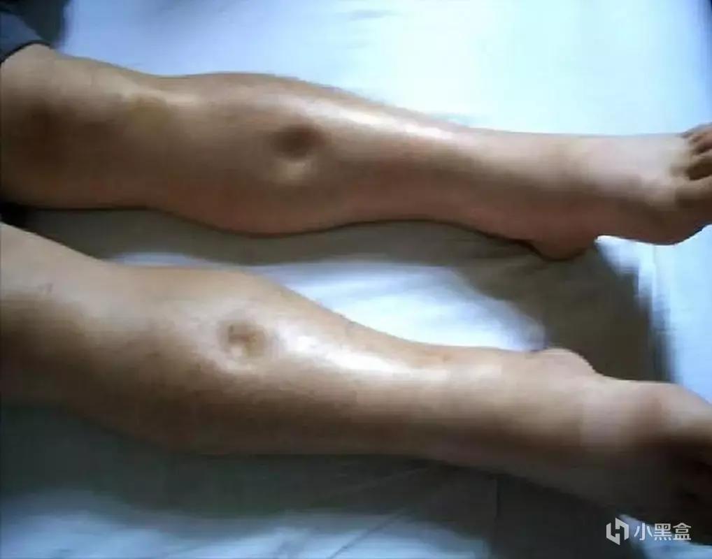 【球盟会】年轻人的身体保养指南：肾虚篇